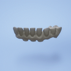 dental-metalic-bridge.gif STL file Dental metalic bridge・3D print model to download