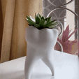 GIF-2021-12-29-02-44-04.gif STL file Tooth Vase, Dentist Gift・3D print design to download