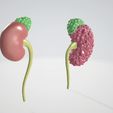 polycystic-kidney.gif 3D polycystic kidney with ureter, adrenal gland