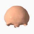 11.gif FRONTAL BONE SEGMENTED 3D MODEL
