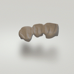 bridge.gif Archivo STL Puente dental・Idea de impresión 3D para descargar
