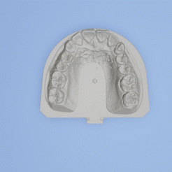 Model-de-studiu.gif Download STL file Dental model study • 3D print template, lablexter