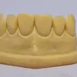 20240103_120634.gif Teeth shape example models