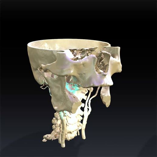 0000000-SKULL-ANATOMY.mp4 SKULL THROAT ANATOMY Human Skeleton BONES NECK DK