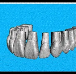 Gif-Maxila.gif STL file Teeth Upper Jaw - Exocad - Robtoly-Unique・Design to download and 3D print