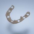 dddasd.gif metal reinforcement for dental prostheses