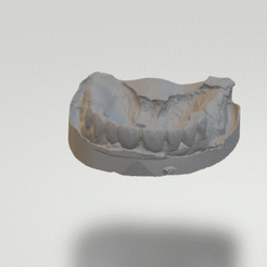 Model-for-partial-dental-framework.gif STL file Model for dental partial framework・3D print object to download, lablexter