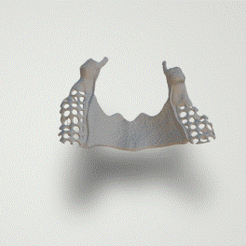 Upperpartialframework.gif STL file Dental UpperJaw partialframework・Design to download and 3D print, lablexter