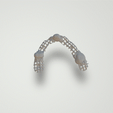 Armature.gif Dental partial framework metal