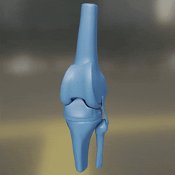 KneeReplacement.gif Archivo 3D Piezas de prótesis de rodilla・Objeto para impresora 3D para descargar