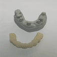 InShot_20231017_113719781.gif Removable tooth bridges, temporary bridges/ Removable tooth bridges, temporary bridges