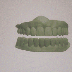 Denture.gif Archivo STL dentaduras・Modelo para descargar y imprimir en 3D